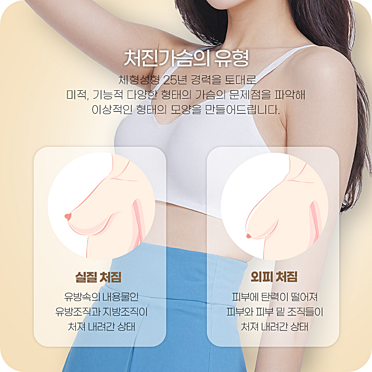 체형성형 25년 경력을 토대로 미적, 기능적 다양한 형태의 가슴의 문제점을 파악해 이상적인 형태의 모양을 만들어드립니다.