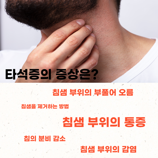 타석증-증상