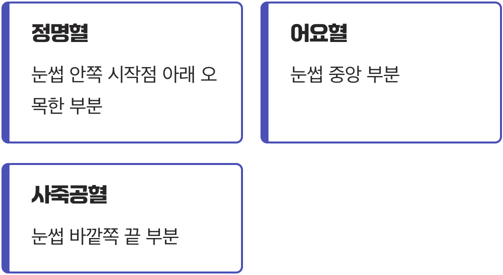 눈 주변 보물찾기, 핵심 혈자리 공략