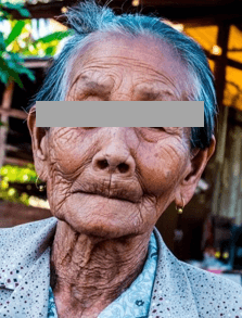 앞니가-모두-빠져-합죽이가-된-할머니