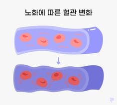 부정맥