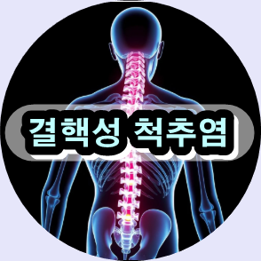 척추 수술 비용, 척추 전문 병원, 감염성 척추 질환 치료, 척추 감염 검사, 척추 수술 후기, 척추 수술 위험성, 척추 클리닉, 척추 건강 관리법, 척추 감염 증상, 척추 재활 운동