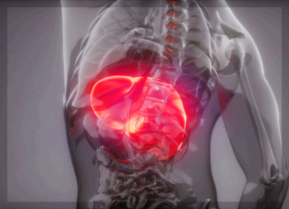 간 혈관종 특징, 원인, 증상, 진단 등 제대로 알기