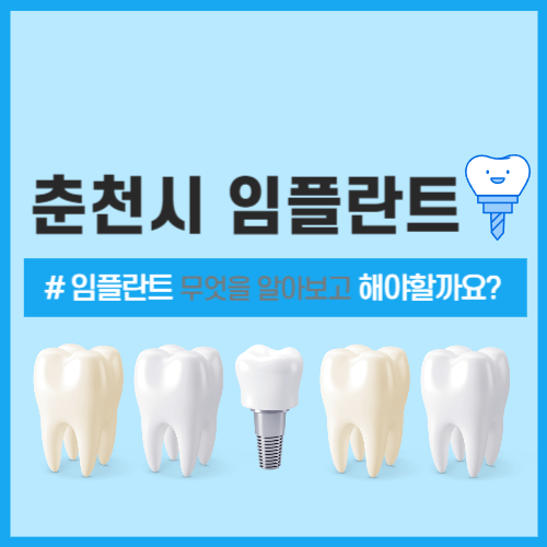 춘천시 임플란트 잘하는 치과