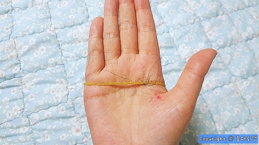 딸려나온-머리카락