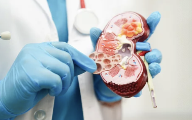 요로결석의 진단