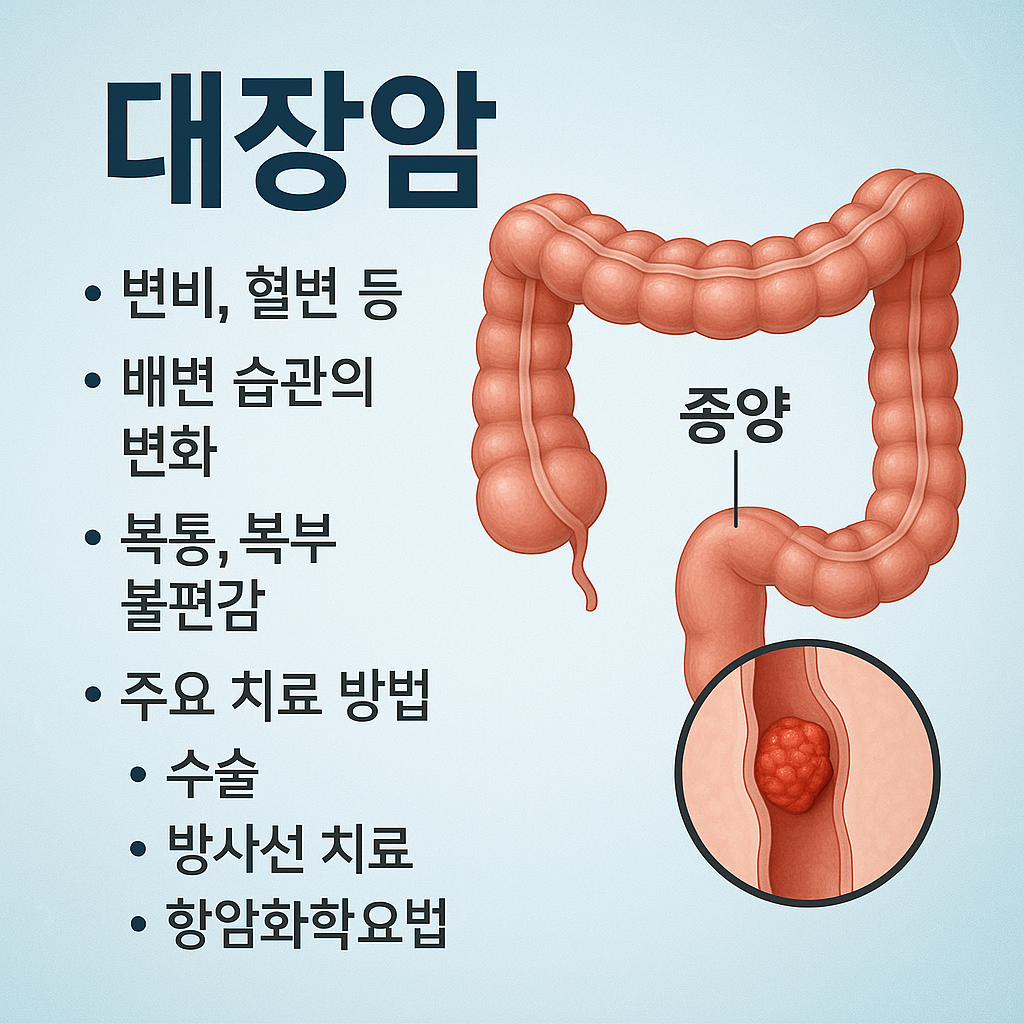 대장암