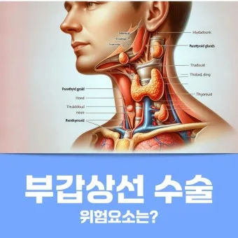 부갑상선기능항진증 수술 후기 2주차 내분비외과 내원 경험담_3