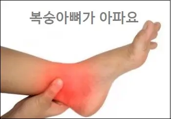 복숭아뼈가 아파요 이유는 뭘까
