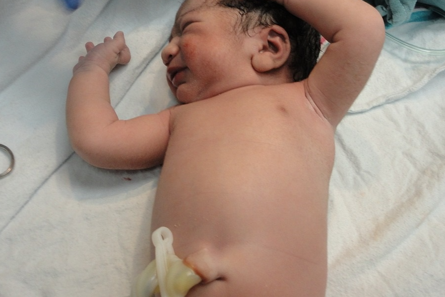 신생아 배꼽 관리하는 방법