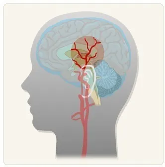 모야모야병 증상 및 원인과 장애등급 여부 알아보기