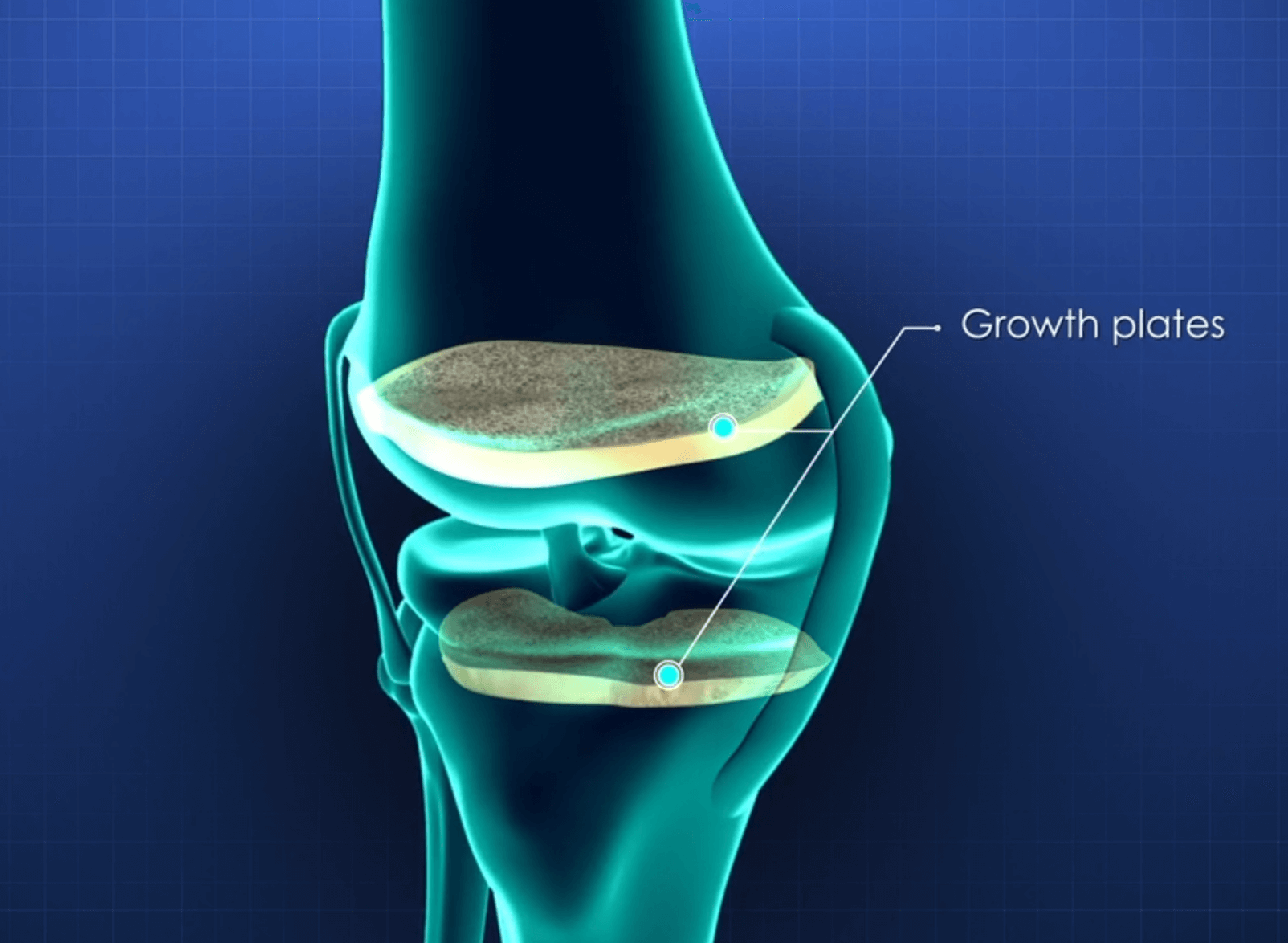 아이-성장판자극기