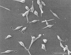 마이코플라즈마 폐렴균(Mycoplasma pneumoniae)