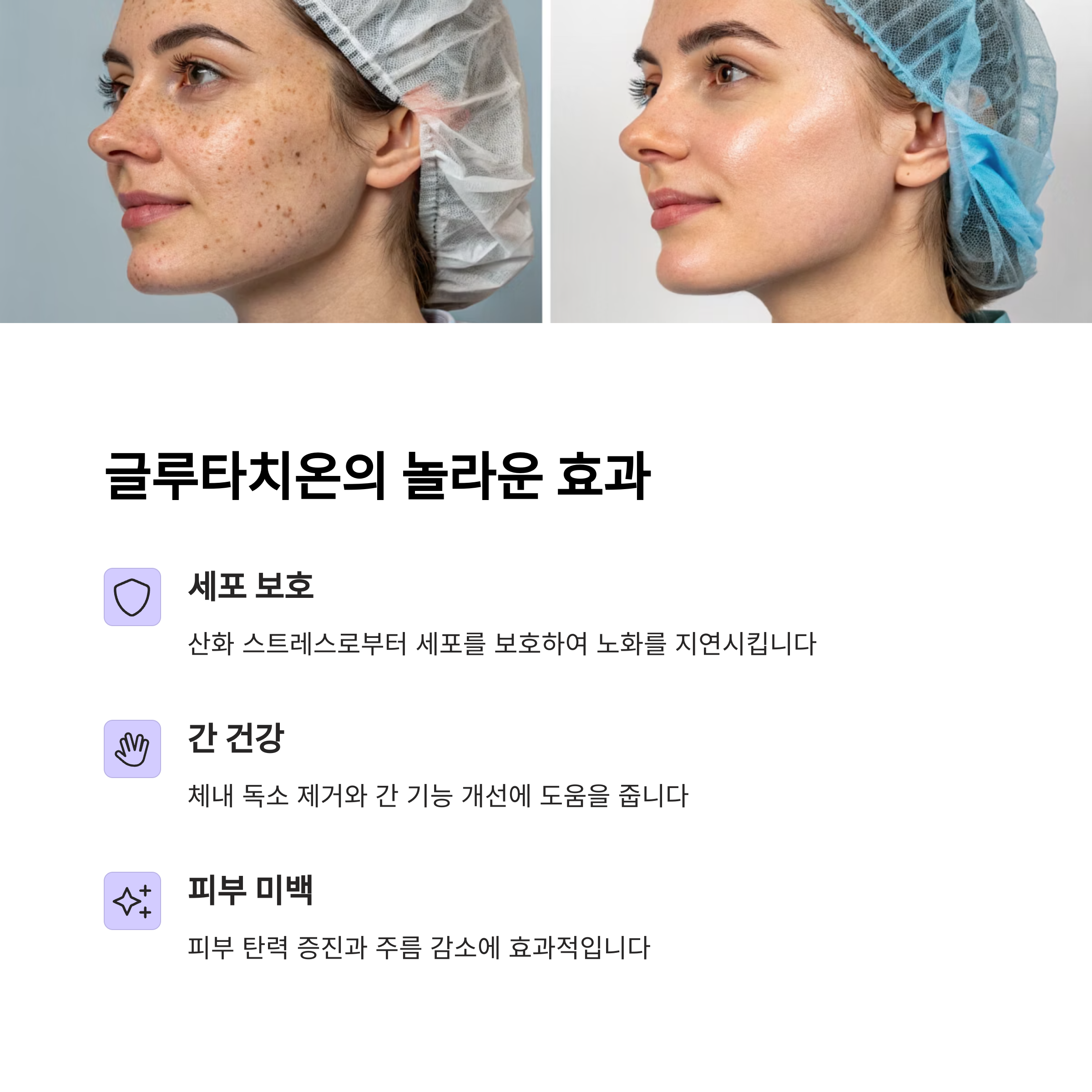 글루타치온