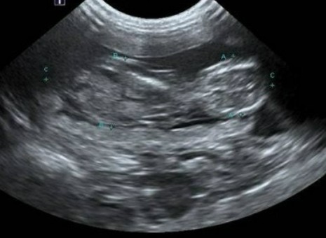 펫 초음파 검사 완벽 가이드 관련 사진