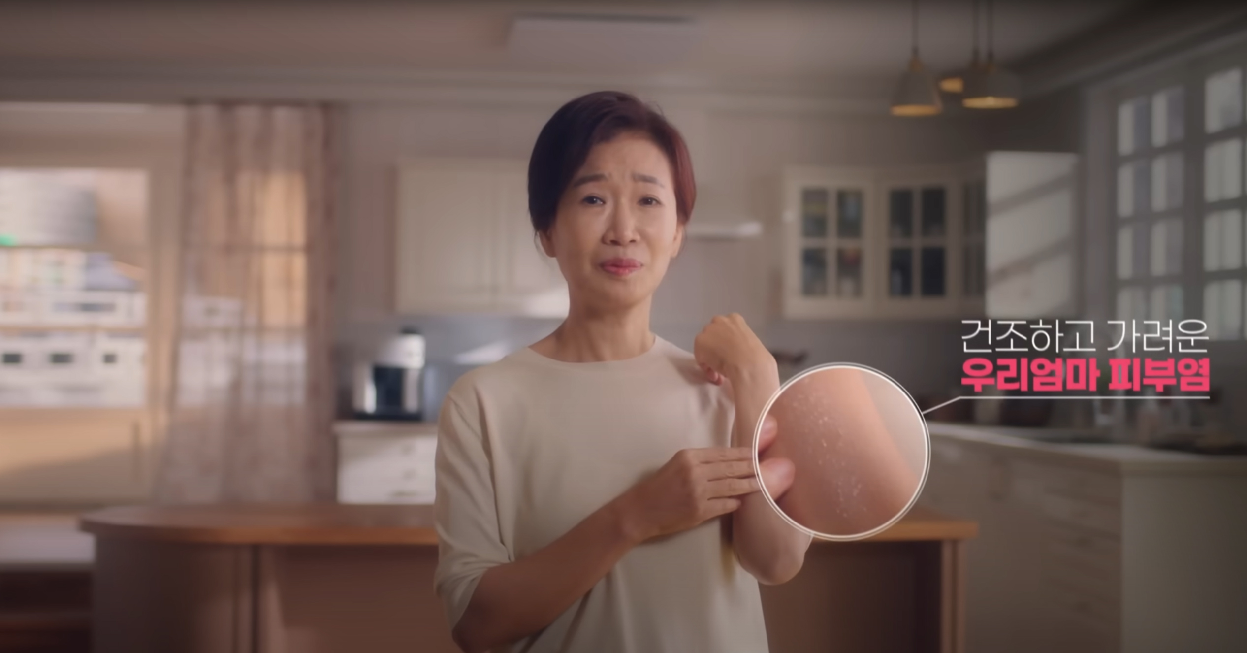 비판텐 연고