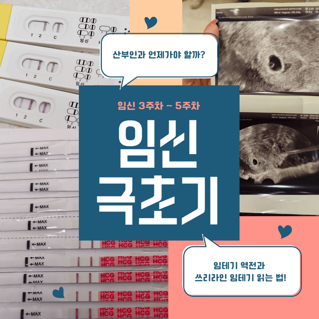 임신-극초기-증상