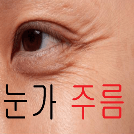 눈가 주름이 심한 여성