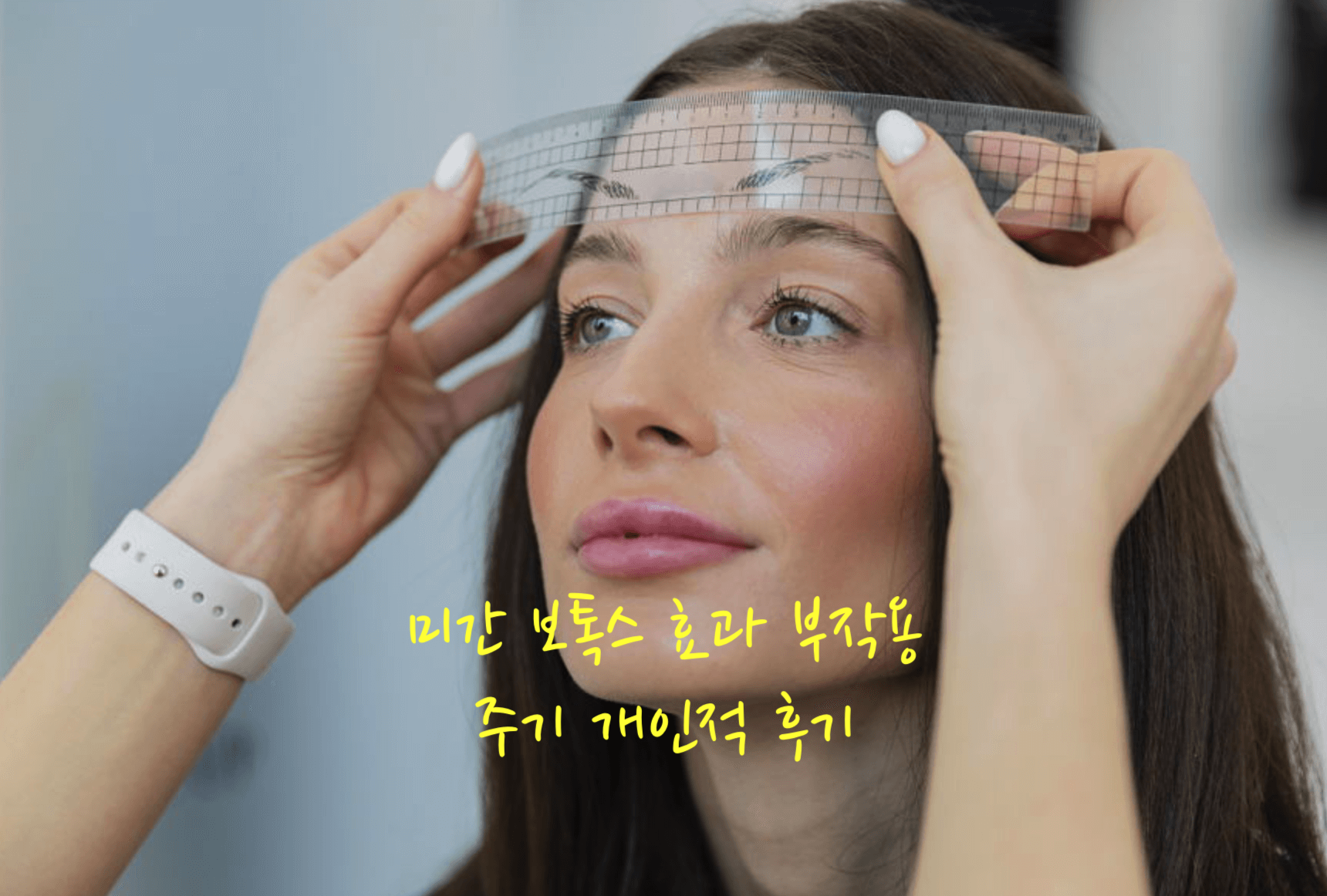 미간 보톡스