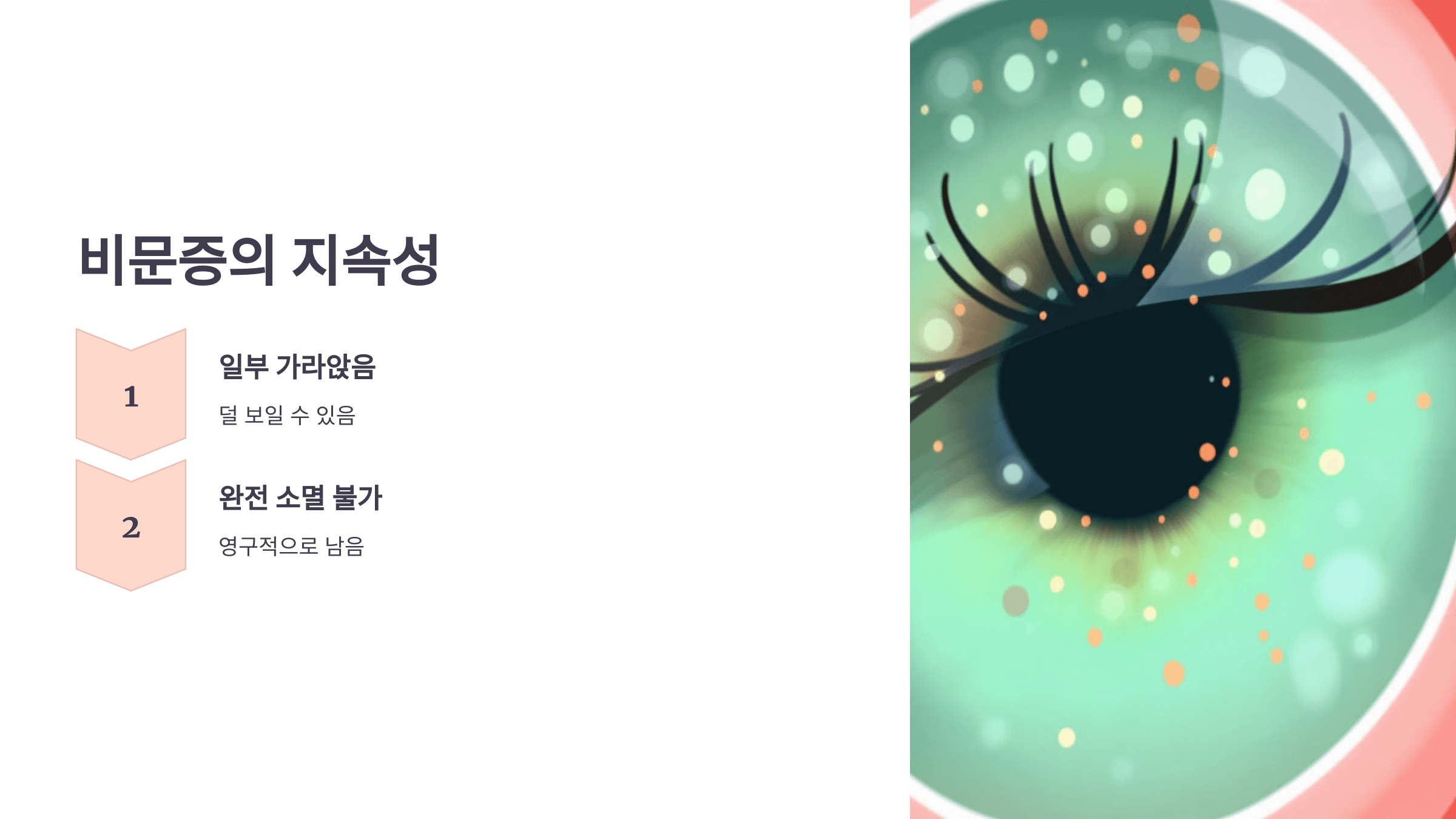 비문증과 관련된 사진입니다.