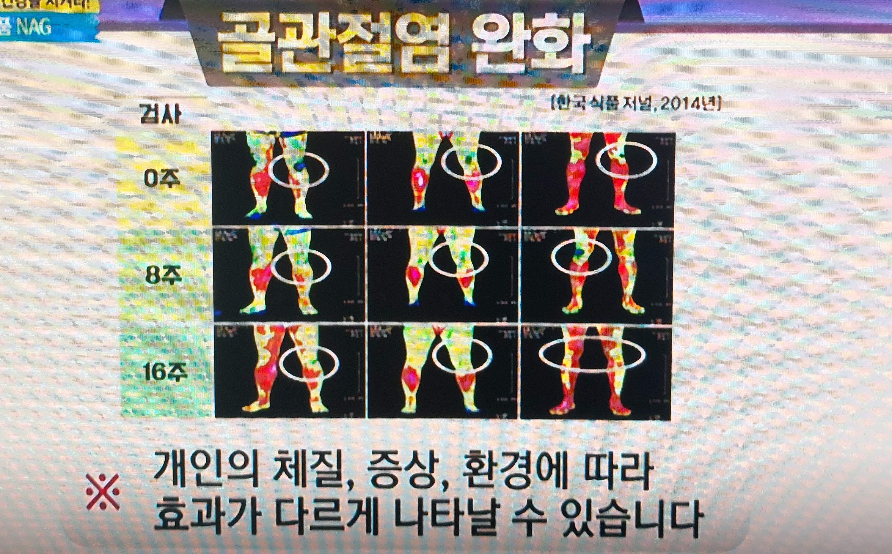 NAG 효능
