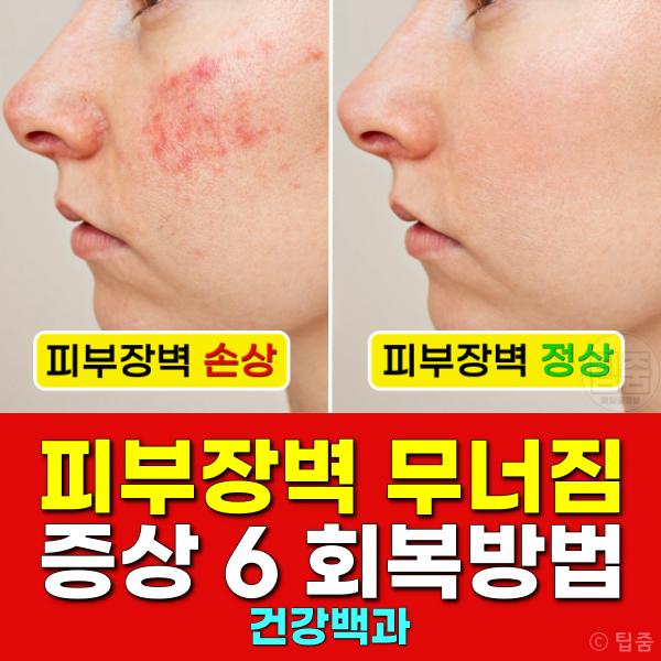 피부장벽 무너짐 증상 피부장벽무너졌을때