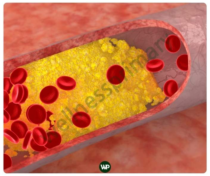 다이글로메라 효능
