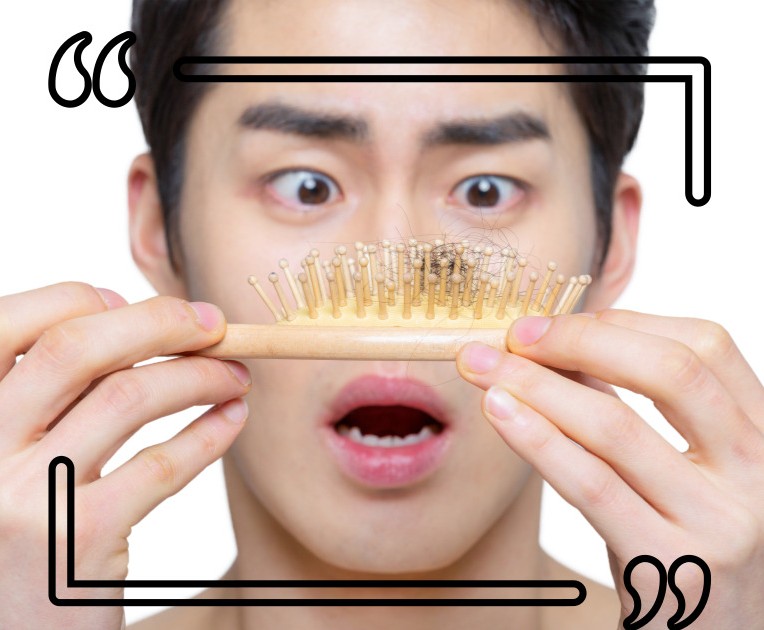 정수리 탈모