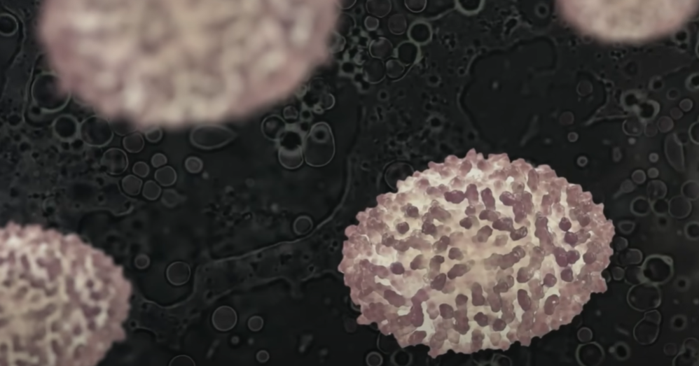 천연두 백신 및 치료제 (+ 증상 전염 수두 차이점)