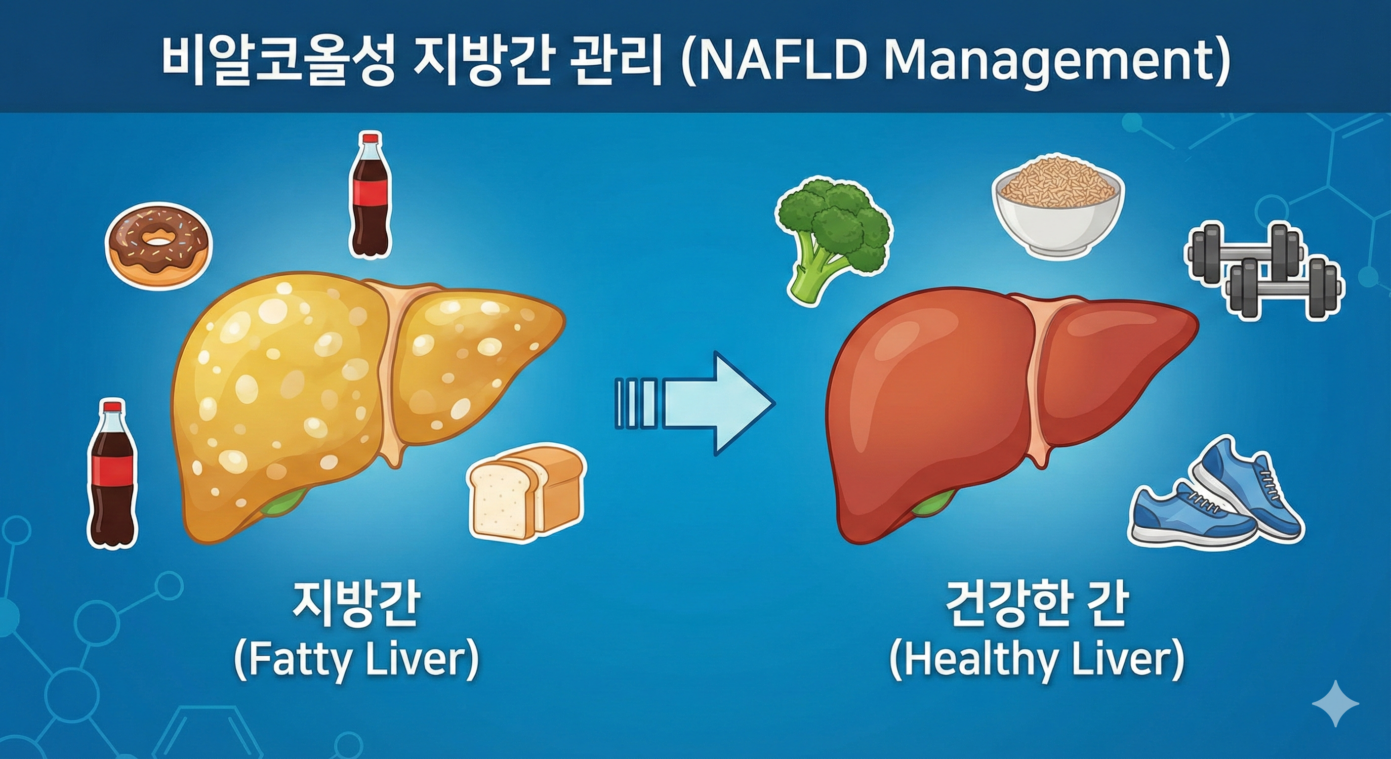 지방간 없애는 방법: 술을 안 마셔도 생기는 비알코올성 지방간 관리 이미지