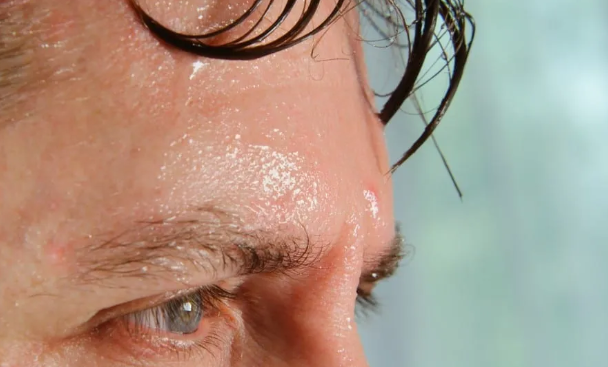 머리에서 땀이 많이 나는 이유