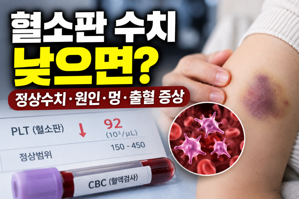 혈소판 수치 낮으면｜정상수치&middot;원인&middot;멍&middot;출혈 증상