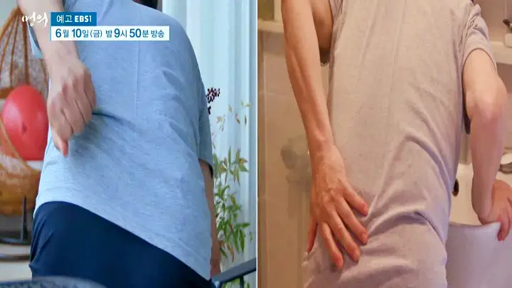 명의 허리통증 치료 디스크 수술 없이 낫게하는 자세 치료법 재활의학과 정선근 교수