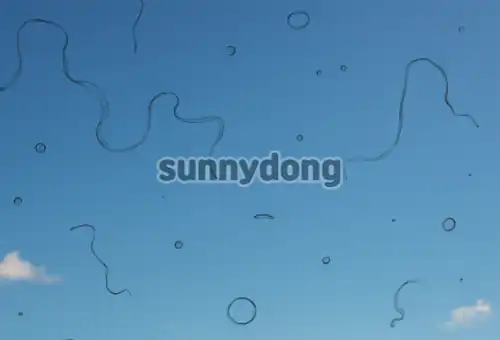 비문증 증상 이미지