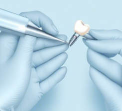 임플란트 의료보험적용대상