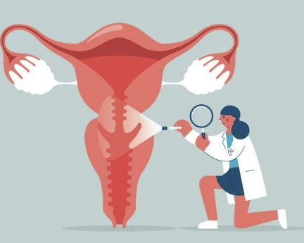 자궁근종 증상과 원인, 싸게 수술하는 방법