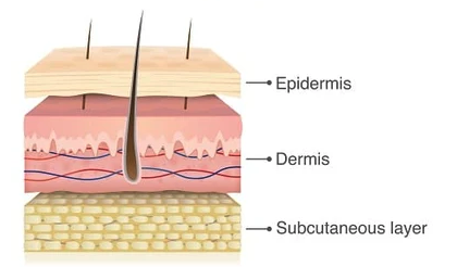 콜라겐 복용의 효과 진짜 있을까 저분자 콜라겐