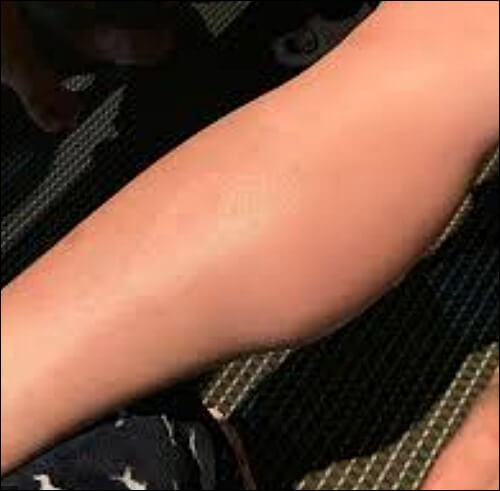 종아리 쥐나는 이유와 해결방법 5