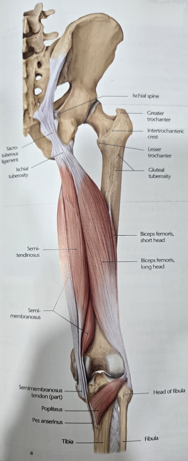 슬관절 신전을 동반한 고관절 신전 증후군 (Hip Extension with Knee Extension Syndrome)