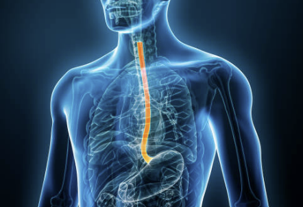 역류성식도염에 좋은음식&amp;#44; 나쁜음식&amp;#44; 증상 자연치료방법 총정리(2024ver)