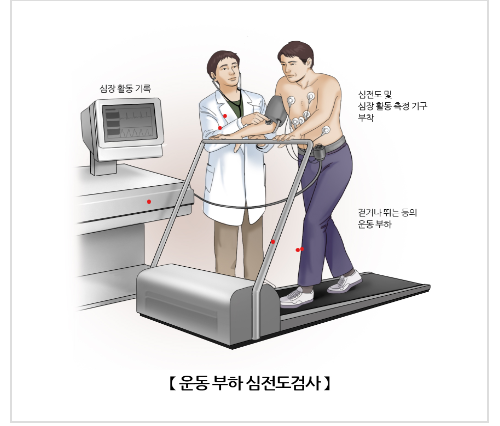 운동부하심전도검사