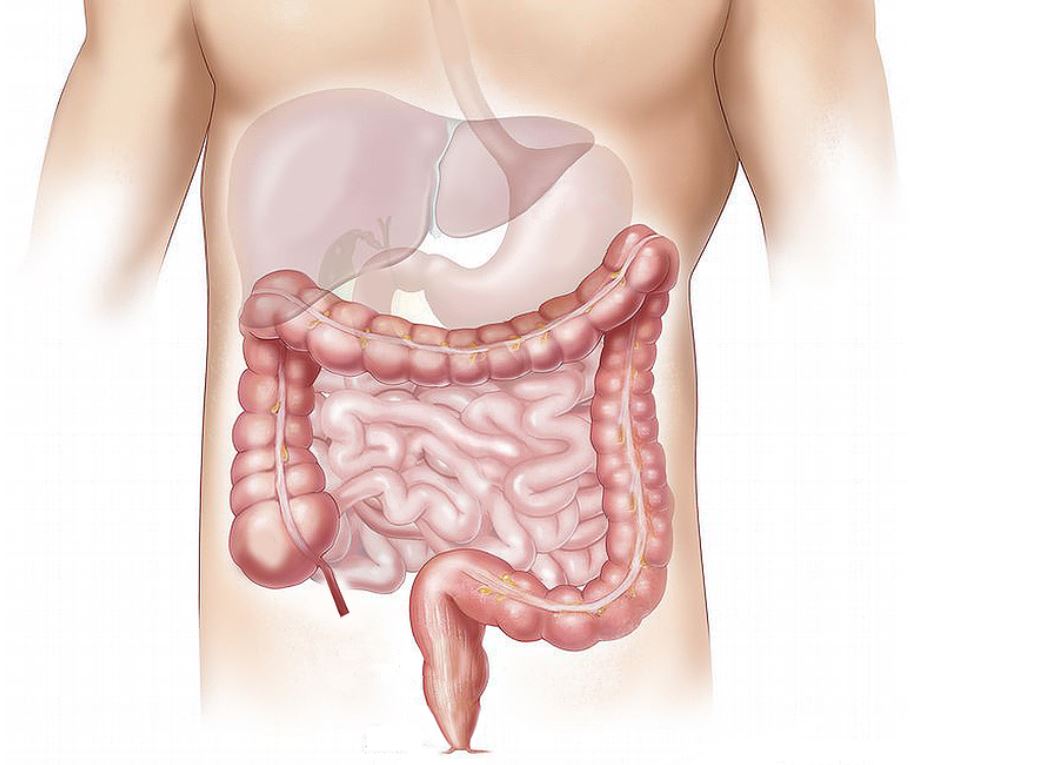 대장암 초기증상