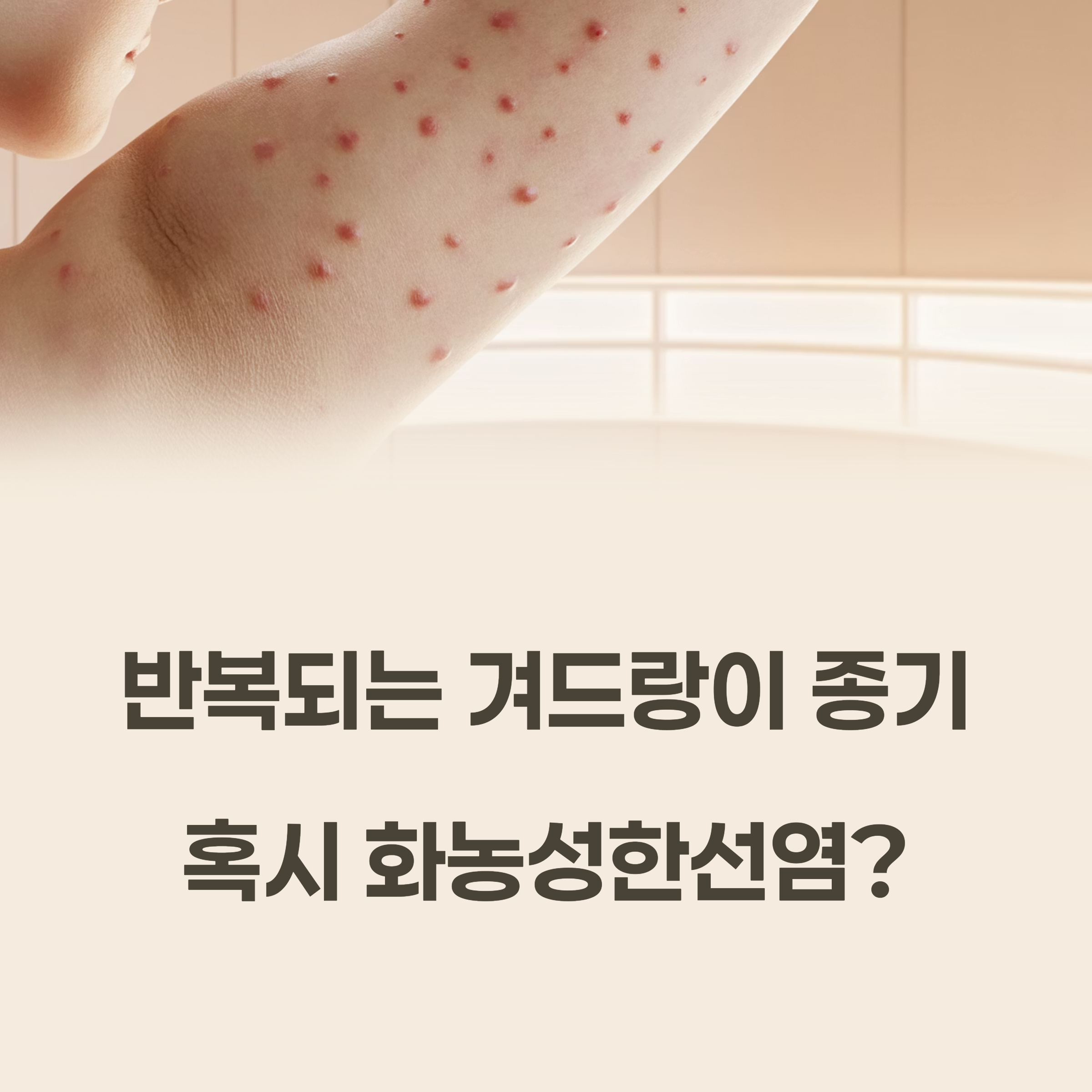 반복되는 겨드랑이 종기, 혹시 화농성한선염일까?