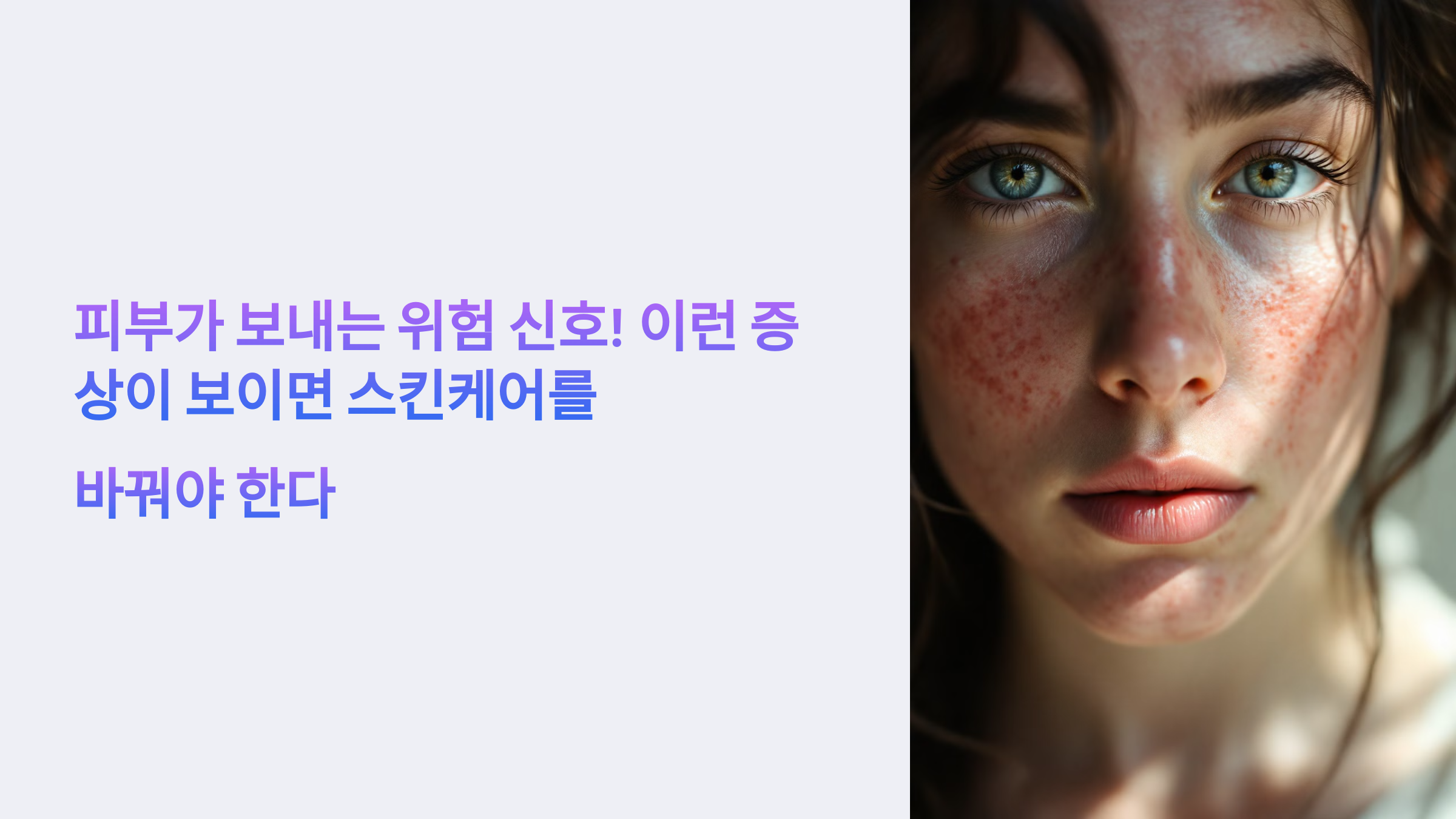 피부 트러블에 관련된 사진