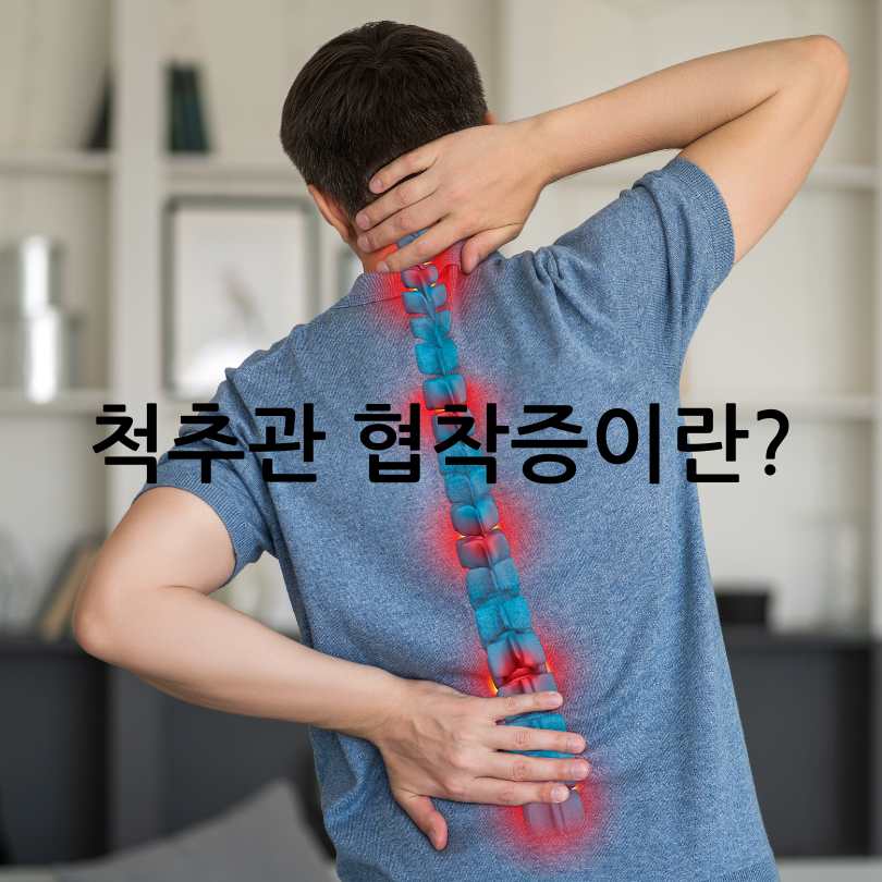 허리디스크와 허리 협착증의 차이점