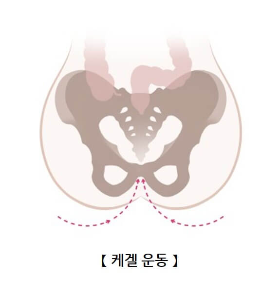 요실금 치료방법&amp;#44; 요실금 수술 비용&amp;#44; 요실금 팬티&amp;#44; 요실금 치료기 추천&amp;#44; 요실금 병원