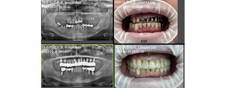 여주시 틀니 병원