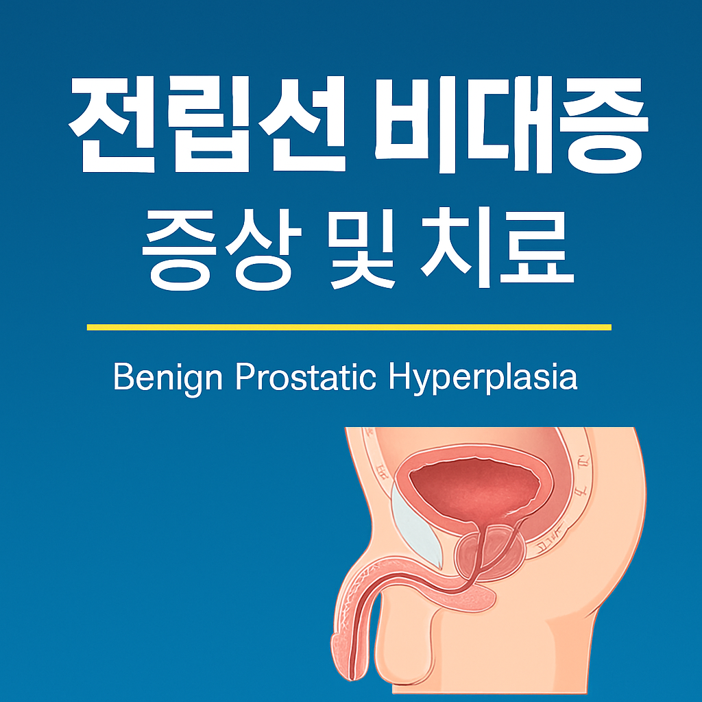전립선 비대증 증상 및 치료