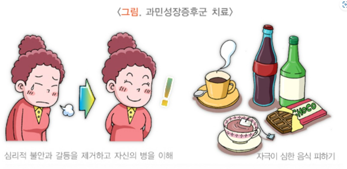 과민성대장증후군 증상·원인·치료 총정리