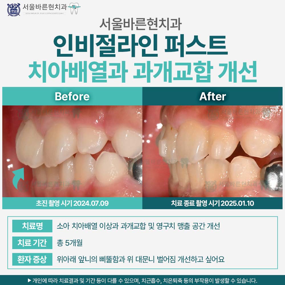 해운대인비절라인퍼스트